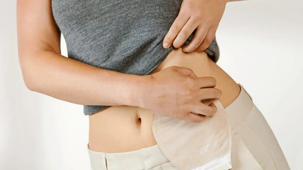 Ostomia